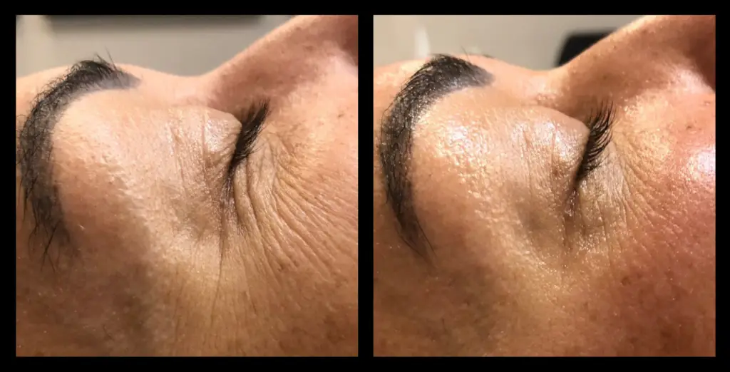 aGlo Salon & Skin Clinic